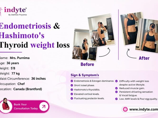 Endometriosis Diet Plan