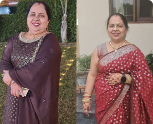 Mrs. Sharmila Mehra PCOS transformation