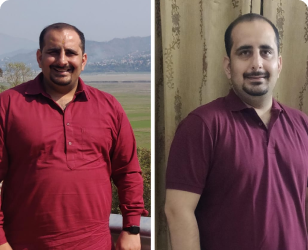 Mr. Harish Sindhu PCOS transformation