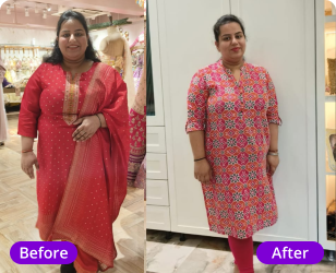 Sakshi PCOS transformation