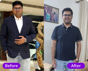 Mr. Sameer fatty liver transformation