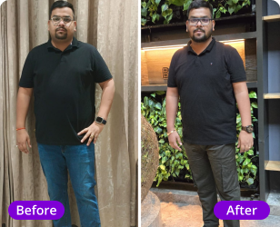 Aakash fatty liver transformation