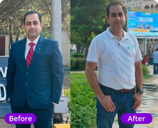 Mr. Rajesh Man fatty liver transformation