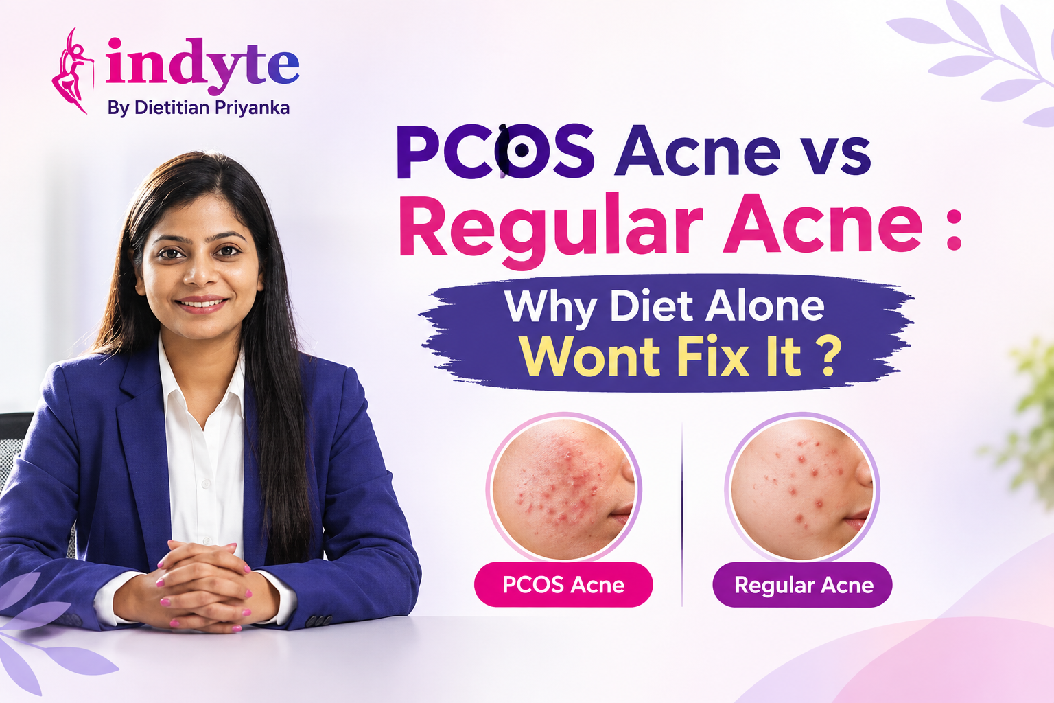 PCOS Acne vs Regular Acne